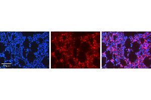Rabbit Anti-ADRBK1 Antibody Catalog Number: ARP51965_P050 Formalin Fixed Paraffin Embedded Tissue: Human Bone Marrow Tissue Observed Staining: Cytoplasm, Plasma membrane Primary Antibody Concentration: 1:600 Other Working Concentrations: N/A Secondary Antibody: Donkey anti-Rabbit-Cy3 Secondary Antibody Concentration: 1:200 Magnification: 20X Exposure Time: 0.