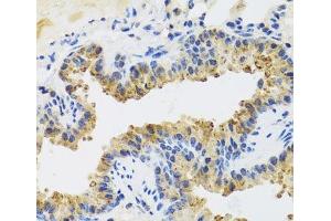 Immunohistochemistry of paraffin-embedded Mouse lung using UVRAG Polyclonal Antibody at dilution of 1:100 (40x lens). (UVRAG anticorps)