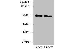 Western blot All lanes: ABHD2 antibody at 10 μg/mL Lane 1: Mouse heart tissue Lane 2: Rat gonadal tissue Secondary Goat polyclonal to rabbit IgG at 1/10000 dilution Predicted band size: 49 kDa Observed band size: 49 kDa (ABHD2 anticorps  (AA 31-320))