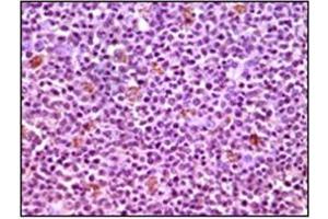 Immunohistochemistry (IHC) image for anti-Induced Myeloid Leukemia Cell Differentiation Protein Mcl-1 (MCL1) antibody (ABIN1108171) (MCL-1 anticorps)
