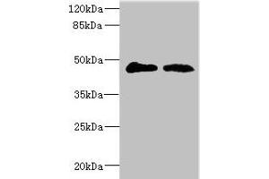 Western blot All lanes: GCNT2 antibody at 3. (GCNT2 anticorps  (AA 203-402))