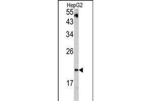 Western blot analysis of VHL antibody (C-term) (ABIN390463 and ABIN2840833) in HepG2 cell line lysates (35 μg/lane).