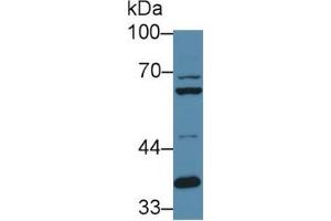 Rabbit Capture antibody from the kit in WB with Positive Control: Sample Human hela cell lysate. (FURIN Kit ELISA)