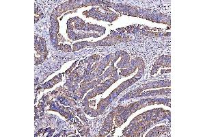 IHC analysis of STON1 using anti-STON1 antibody (ABIN7599896). (STON1 anticorps  (AA 127-688))