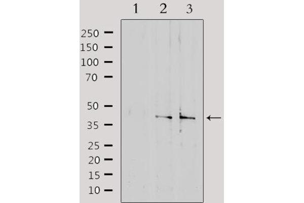 SLC15A1 anticorps  (Internal Region)