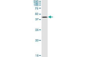 ACAT2 MaxPab rabbit polyclonal antibody. (ACAT2 anticorps  (AA 1-397))