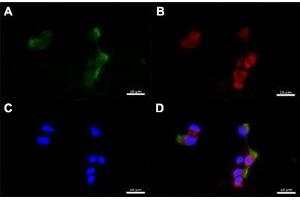 Immunofluorescent staining of human nasal epithelial cells with CD151 polyclonal antibody  at 1:100 dilution. (CD151 anticorps  (C-Term))