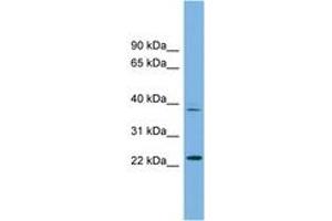 Image no. 1 for anti-Transcription Factor Dp Family, Member 3 (TFDP3) (AA 71-120) antibody (ABIN6745240) (TFDP3 anticorps  (AA 71-120))