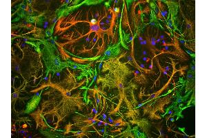 View of mixed neuron/glial cultures stained with vimentin antibody (green) and rabbit antibody to GFAP antibody (red). (Vimentin anticorps)