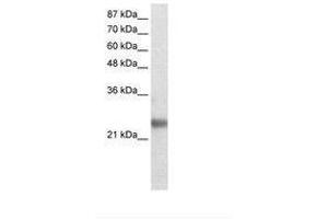 Image no. 1 for anti-Ring Finger Protein 114 (RNF114) (AA 77-126) antibody (ABIN202094) (RNF114 anticorps  (AA 77-126))