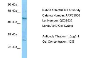 Western Blotting (WB) image for anti-Corticotropin Releasing Hormone Receptor 1 (CRHR1) (N-Term) antibody (ABIN2774376)