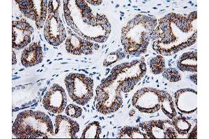Image no. 5 for anti-Adenylate Kinase 4 (AK4) antibody (ABIN1496525)
