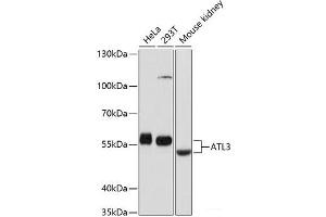 Western blot analysis of extracts of various cell lines using ATL3 Polyclonal Antibody at dilution of 1:1000. (ATL3 anticorps)