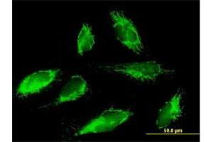 Immunofluorescence of purified MaxPab antibody to SCO1 on HepG2 cell.