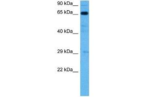 Host:  Mouse  Target Name:  SLC6A2  Sample Tissue:  Mouse Skeletal Muscle  Antibody Dilution:  1ug/ml