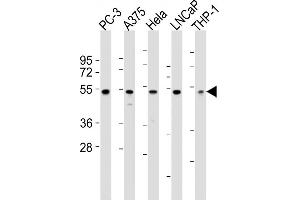 All lanes : Anti-NFKBIE Antibody (N-term) at 1:2000 dilution Lane 1: PC-3 whole cell lysates Lane 2:  whole cell lysates Lane 3: Hela whole cell lysates Lane 4: LNCaP whole cell lysates Lane 5: THP-1 whole cell lysates Lysates/proteins at 20 μg per lane. (NFKBIE anticorps  (N-Term))