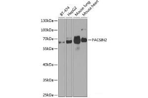 Western blot analysis of extracts of various cell lines using PACSIN2 Polyclonal Antibody at dilution of 1:1000. (PACSIN2 anticorps)