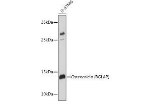 Western blot analysis of extracts of U-87MG cells, using Osteocalcin (BGLAP) antibody (ABIN6134565, ABIN6137546, ABIN6137547 and ABIN6221793) at 1:1000 dilution. (Osteocalcin anticorps  (AA 1-100))