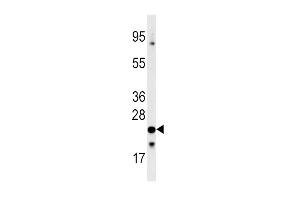 Western blot analysis of anti-FXN Antibody (C-term) (ABIN390377 and ABIN2840779) in 293 cell line lysates (35 μg/lane). (Frataxin anticorps  (C-Term))