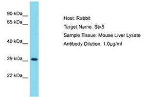 Image no. 1 for anti-Syntaxin 8 (STX8) (AA 161-210) antibody (ABIN6750455)