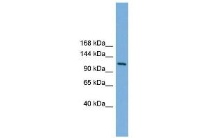 WB Suggested Anti-Myt1 Antibody Titration: 0. (MYT1 anticorps  (N-Term))