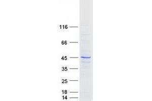Validation with Western Blot