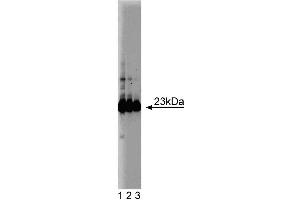 Western blot analysis of GST-pi on a HeLa cell lysate (Human cervical epitheloid carcinoma, ATCC CCL-2. (GSTP1 anticorps  (AA 5-210))
