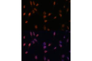 Immunofluorescence analysis of NIH-3T3 cells using USP33 Polyclonal Antibody (ABIN7271157) at dilution of 1:100 (40x lens).