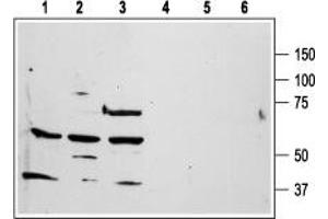Western blot analysis of human promyelocytic leukemia HL-60 (lanes 1 and 4), human T-cell leukemia Jurkat (lanes 2 and 5), and chronic myelogenous leukemia K562 (lanes 3 and 6) cell line lysates: - 1-3.