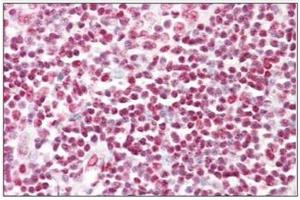 Human Tonsil: Formalin-Fixed, Paraffin-Embedded (FFPE)