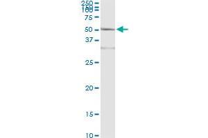 Immunoprecipitation of ACY1 transfected lysate using anti-ACY1 monoclonal antibody and Protein A Magnetic Bead , and immunoblotted with ACY1 MaxPab rabbit polyclonal antibody. (Aminoacylase 1 anticorps  (AA 1-408))