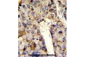 Immunohistochemistry (IHC) image for anti-Heterogeneous Nuclear Ribonucleoprotein L (HNRNPL) antibody (ABIN3001739)