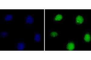Immunofluorescence analysis of 293T cells using Symmetric DiMethyl-Histone H3-R8 Polyclonal Antibody (Histone 3 anticorps  (H3R8me2s))
