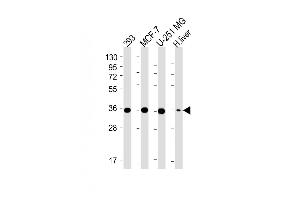 All lanes : Anti-PDXK Antibody (N-term) at 1:4000 dilution Lane 1: 293 whole cell lysate Lane 2: MCF-7 whole cell lysate Lane 3: U-251 MG whole cell lysate Lane 4: Human liver lysate Lysates/proteins at 20 μg per lane. (PDXK anticorps  (AA 1-312))