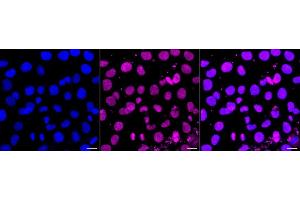 Immunocytochemical staining of HT- cells with SENP2 antibody (ABIN7800976), 1:1,000). (Recombinant SUMO Specific Peptidase 2 anticorps)
