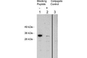 Western blot using  X1874P, rabbit polyclonal at 0. (FHL2 anticorps)
