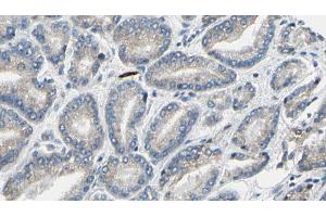 ABIN6269323 at 1/100 staining Human prostate tissue by IHC-P. (LIPE anticorps  (Internal Region))