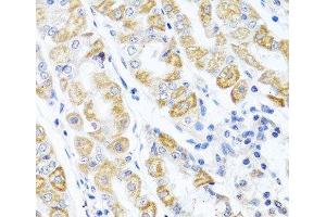 Immunohistochemistry of paraffin-embedded Human stomach using CDKN2C Polyclonal Antibody at dilution of 1:100 (40x lens). (CDKN2C anticorps)