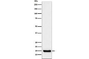 Western blot analysis of TTC11 expression in Raji cell lysate.