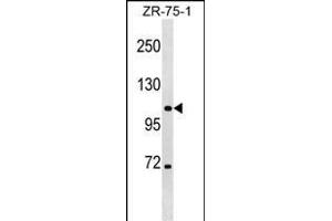 CLCN3 Antibody (Center) (ABIN1538244 and ABIN2848797) western blot analysis in ZR-75-1 cell line lysates (35 μg/lane). (CLCN3 anticorps  (AA 285-313))