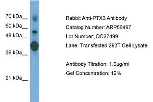 WB Suggested Anti-PTX3  Antibody Titration: 0. (PTX3 anticorps  (N-Term))