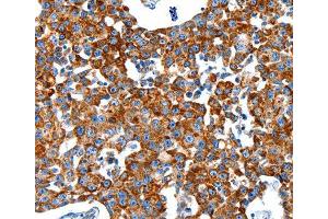 Immunohistochemistry (IHC) image for anti-Kallikrein 2 (KLK2) (AA 25-250) antibody (ABIN6219970) (Kallikrein 2 anticorps  (AA 25-250))