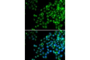 Immunofluorescence analysis of HeLa cells using EPC1 antibody. (EPC1 anticorps)