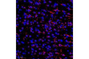 Immunofluorescence of paraffin embedded mouse brain using MAP9 (ABIN7074622) at dilution of 1:750 (300x lens)