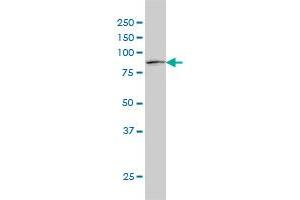 STAT1 monoclonal antibody (M01), clone 1A8 Western Blot analysis of STAT1 expression in HeLa .