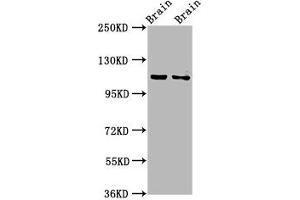 Western Blot Positive WB detected in: Rat brain tissue, Mouse brain tissue All lanes: CLIP2 antibody at 3. (CLIP2 anticorps  (AA 101-217))