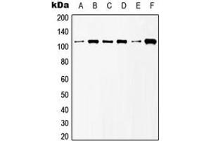 Western blot analysis of mGLUR6 expression in HeLa (A), NIH3T3 (B), Raw264.