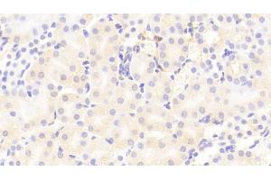 Detection of VCAM1 in Mouse Kidney Tissue using Polyclonal Antibody to Vascular Cell Adhesion Molecule 1 (VCAM1)
