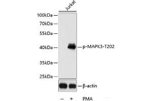 Western blot analysis of extracts of Jurkat cells using Phospho-MAPK3(T202) Polyclonal Antibody at dilution of 1:2000. (ERK1 anticorps  (pThr202))