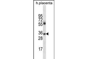 IGHG4 Antibody (Center) (ABIN656801 and ABIN2846018) western blot analysis in human placenta tissue lysates (35 μg/lane). (IGHG4 anticorps  (AA 78-105))